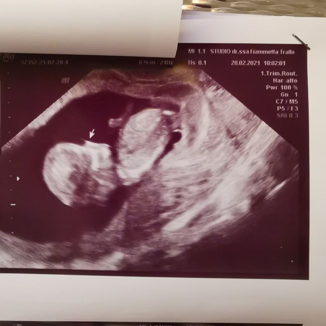 Future Mamme Settembre 2021😍 - 2