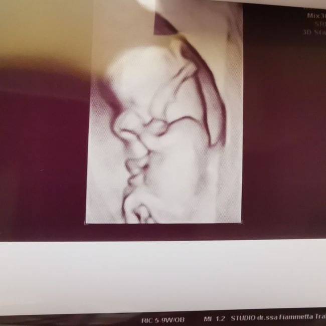 Future Mamme Settembre 2021😍 - 3