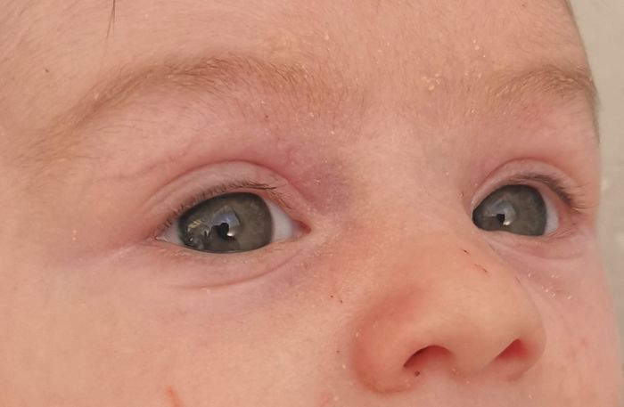 Colore occhi neonato: azzurri o castani? Esperienze cercasi!!!! 3