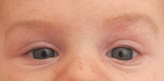 Colore occhi neonato: azzurri o castani? Esperienze cercasi!!!! 4