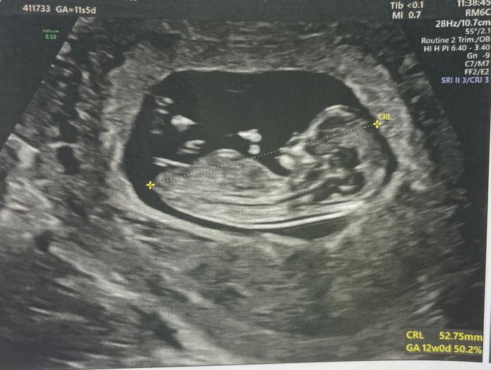 Future mamme Febbraio 2025 - 2