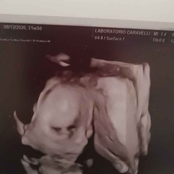 Future Mamme Settembre 2021😍 - 3
