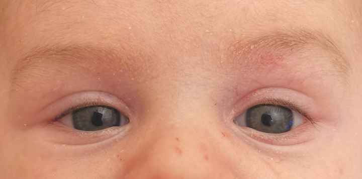 Colore occhi neonato: azzurri o castani? Esperienze cercasi!!!! - 3