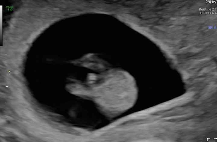 Future mamme Febbraio 2025 - 1