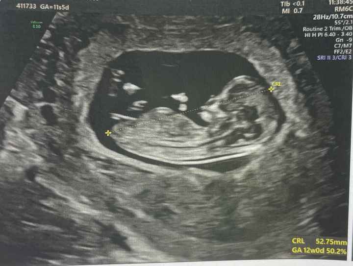Future mamme Febbraio 2025 - 2