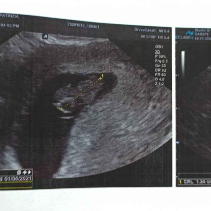 Future mamme Giugno 2021 💛🐠🍀🌻 - 4