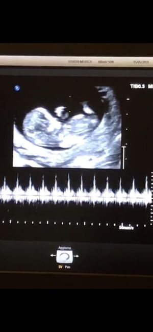 Esperte di Nub Theory a me - 1