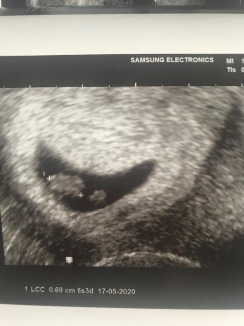 Metodo Ramzi... chi mi aiuta?! - 1