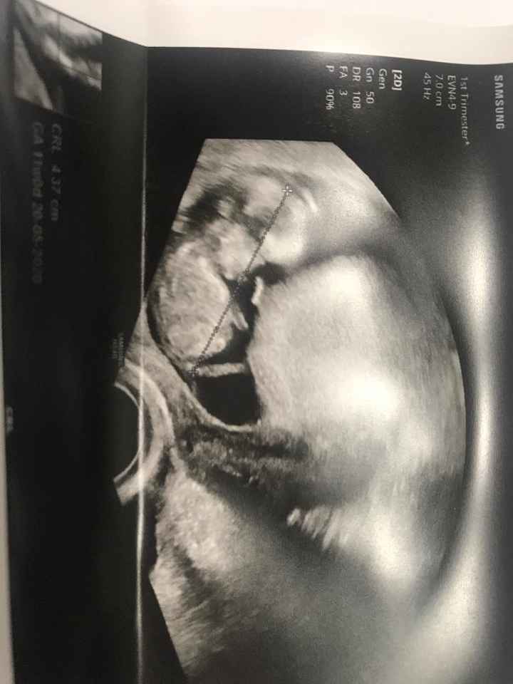 Esperte di Nub Theory a me - 1