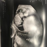 Esperte di Nub Theory a me - 1