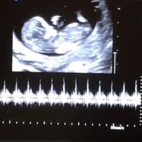 Esperte di Nub Theory a me - 1