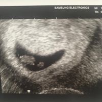 Metodo Ramzi! Chi ci sa azzeccare? - 1