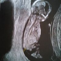 Future mamma settembre 2019 - 1