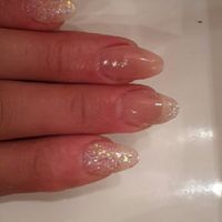 Gel unghie 9 giorni prima. - 1