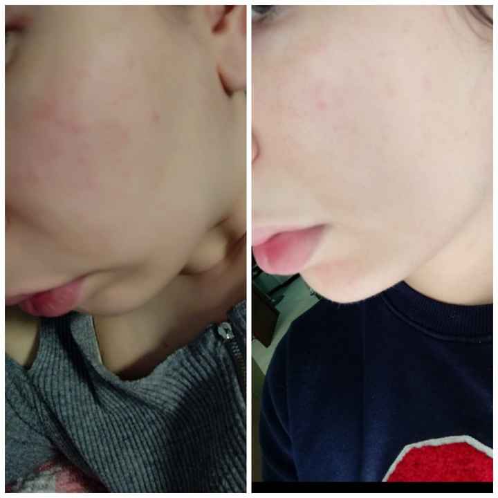 Segni di miglioramento - 1