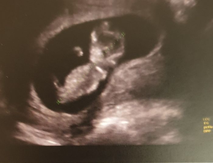 Future mamme novembre 2020 🌞🍁🌷♾ - 1