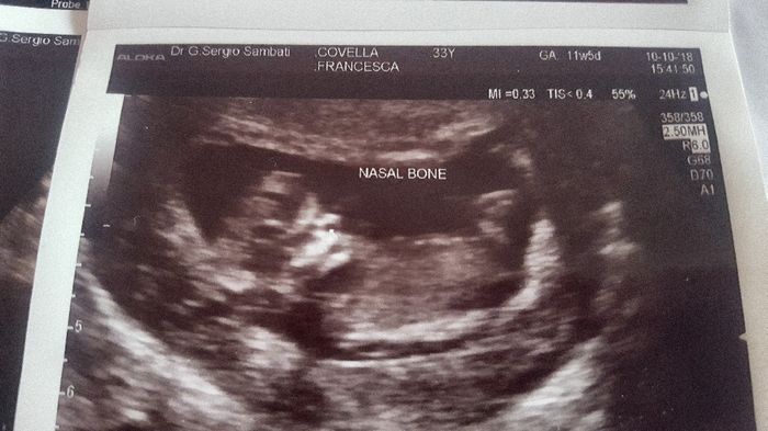 Consigli maschio o femmina 3