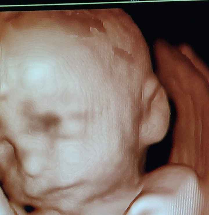 Peso e lunghezza bimbi a 25 settimane! - 1