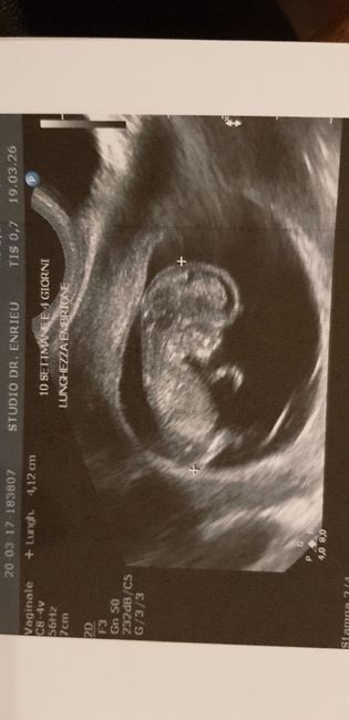 Future mamme ottobre 2020 - 1