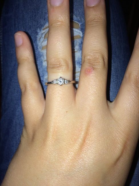 La foto del vostro anello! - 1