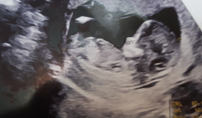 Future mamme di Aprile 2021 🐣 - 1