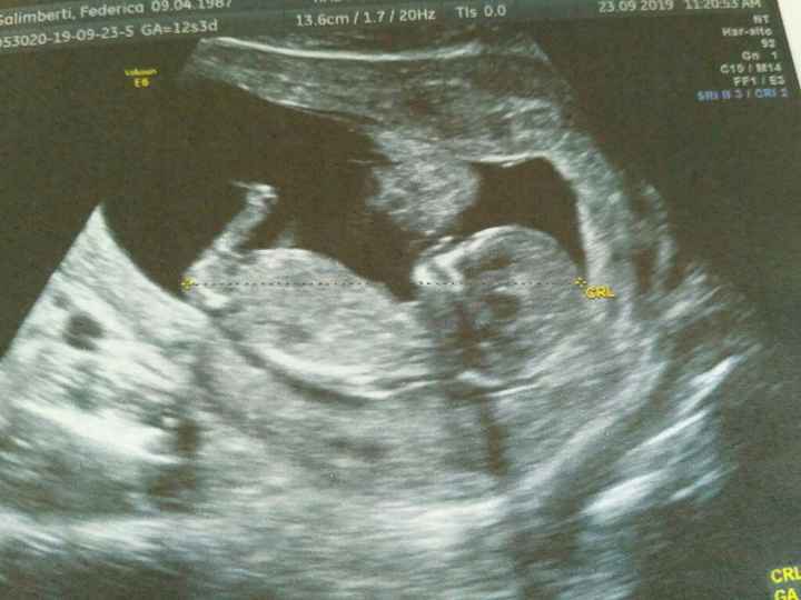 Esperte Nub Theory - 1