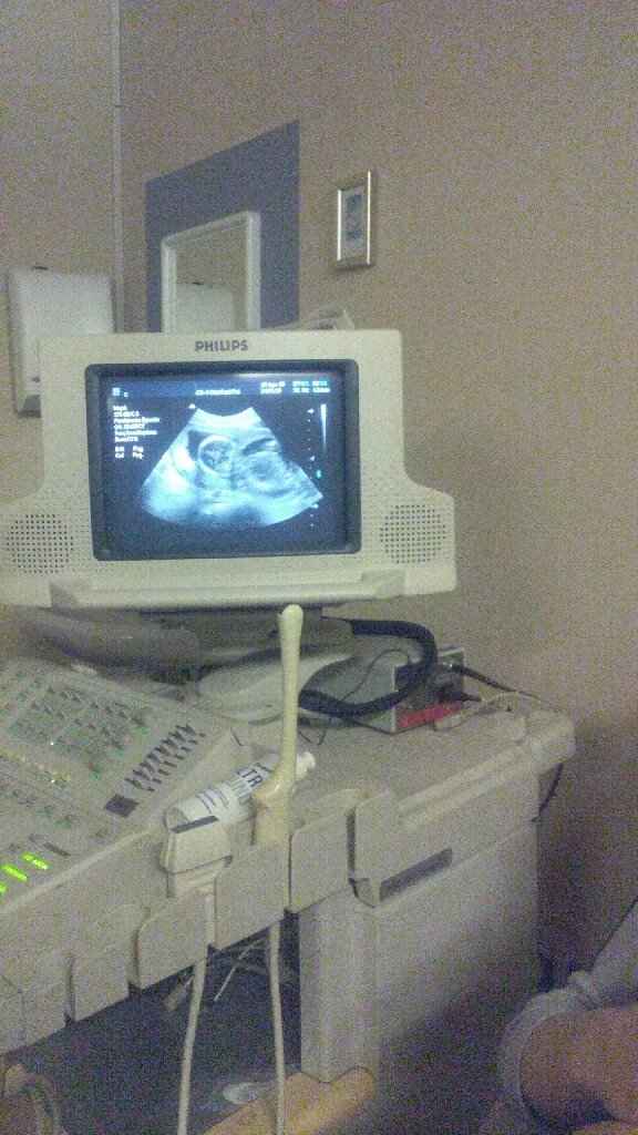 Fiocco azzurro! 😍 - 1