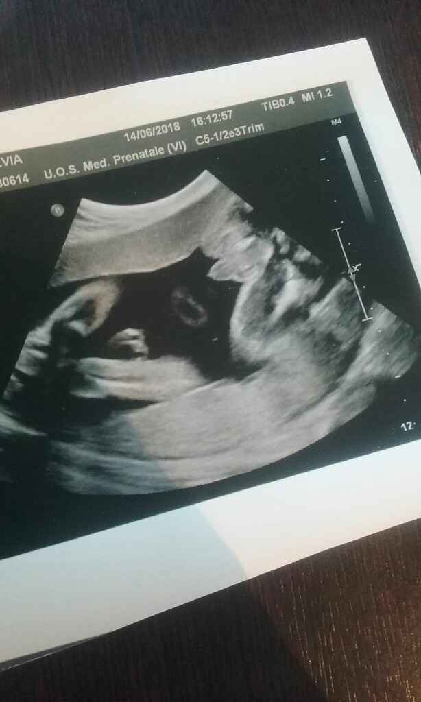 Crampi mestruali a 27 settimane - 1