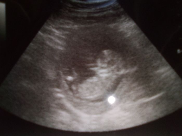 Qualcuna che rivede il proprio figlio/figlia in questa foto? - 1