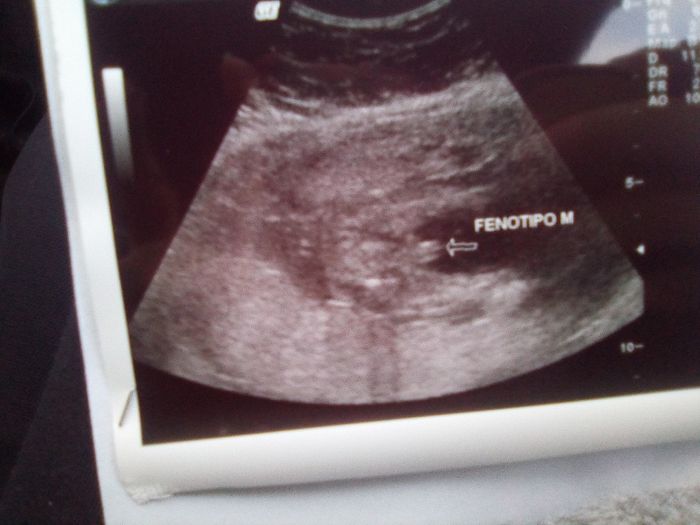 Future mamme maggio 2020 - 1