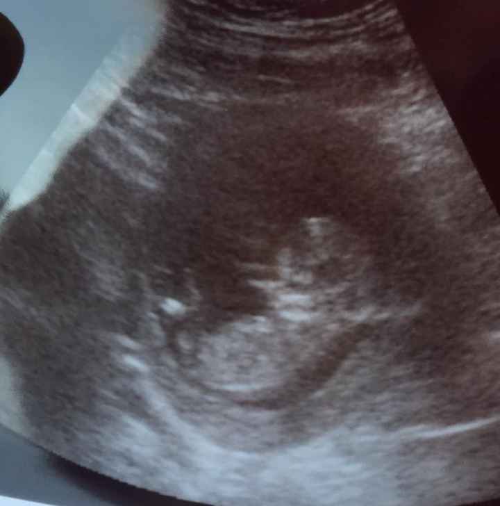 Future mamme maggio 2020 - 1