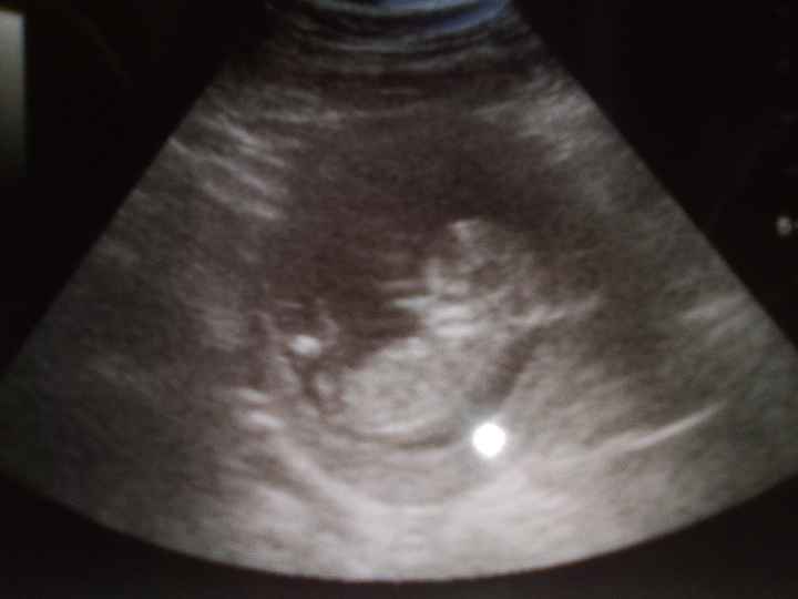 Qualcuna che rivede il proprio figlio/figlia in questa foto? - 1