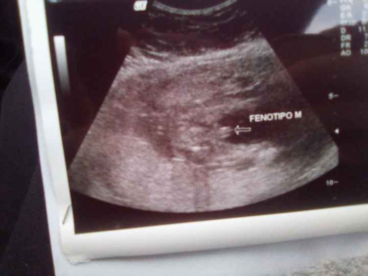 Future mamme maggio 2020 - 1