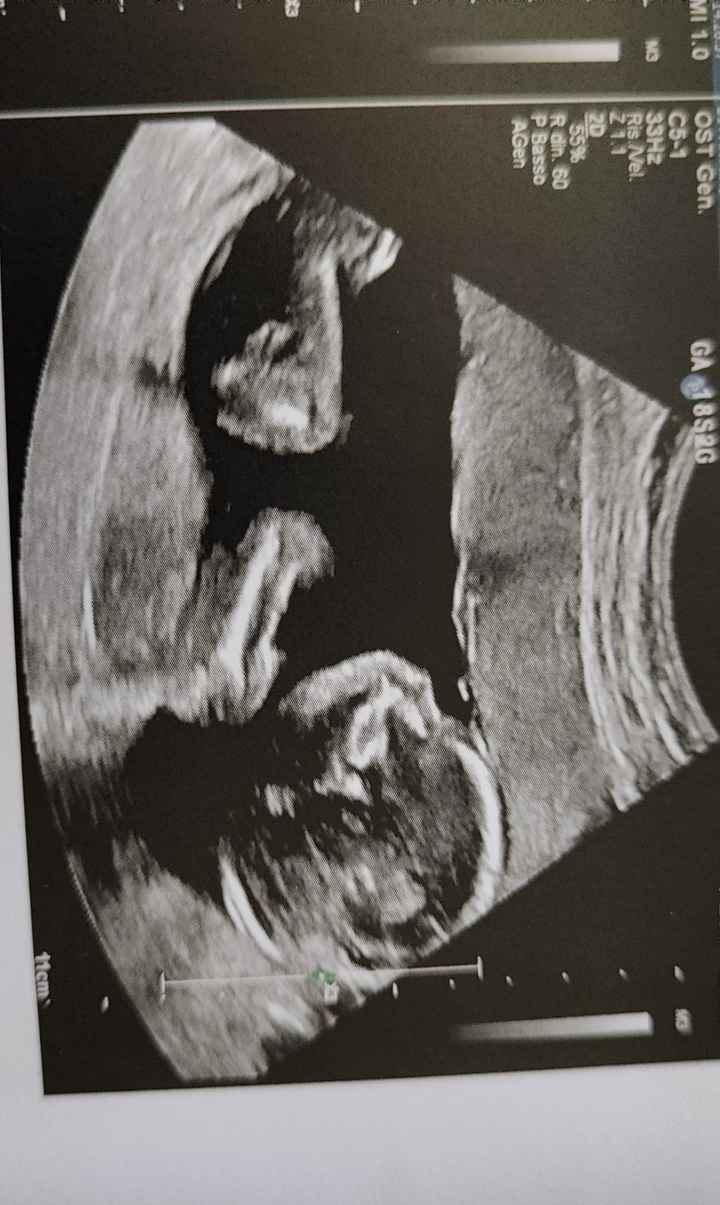 Future mamme ottobre 2024 - nuovo gruppo - 3