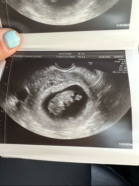 Metodo Ramzi 💖💙 - 1