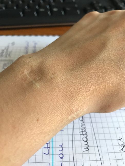 Piedi distrutti... Help! 1