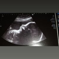 Mutanda o assorbente post parto? - 1