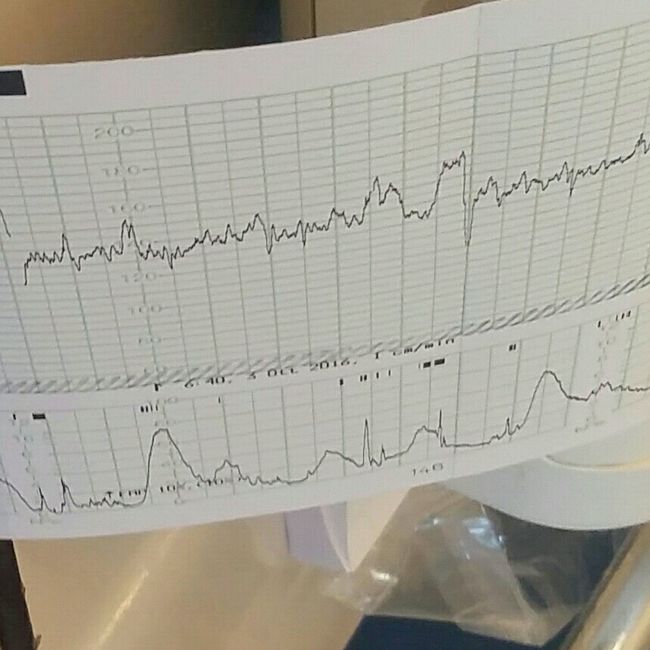 Risultati primo tracciato. qualcuno sa spiegarmi? - 1