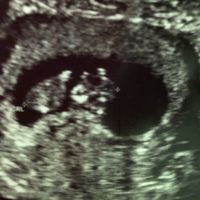 Due domandine 😜 - 2