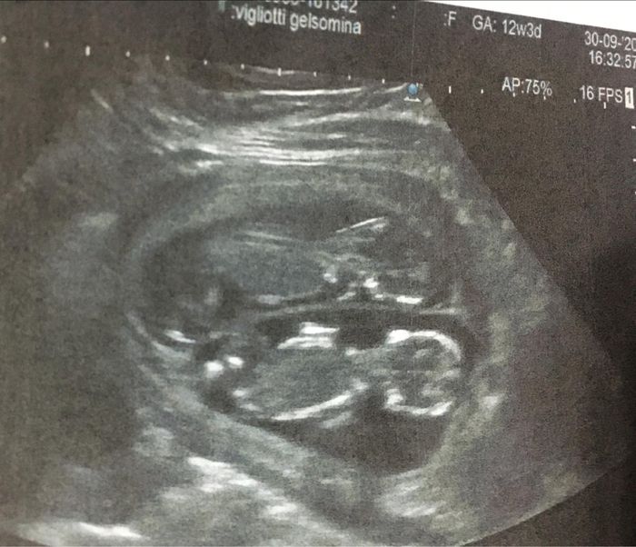 Future mamme di Aprile 2021 🐣 - 1