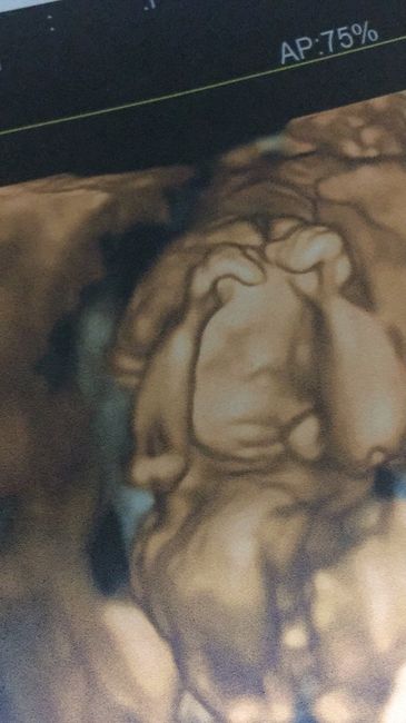 Future mamme di Aprile 2021 🐣 - 2