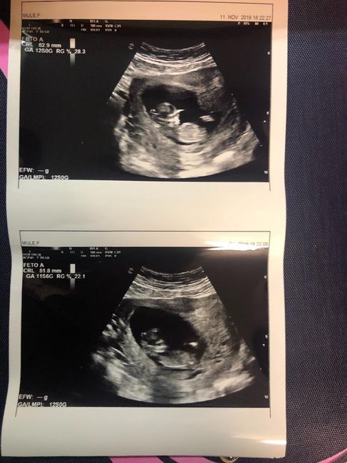 Esperte Nub Theory - 1