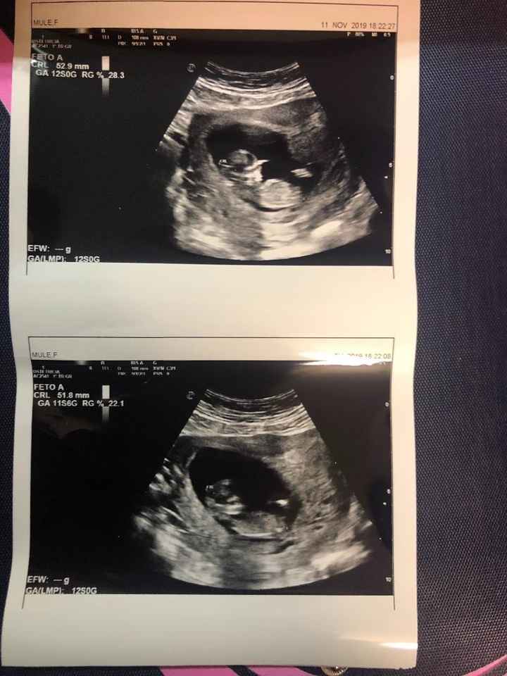 Esperte Nub Theory - 1