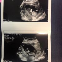 Esperte Nub Theory - 1