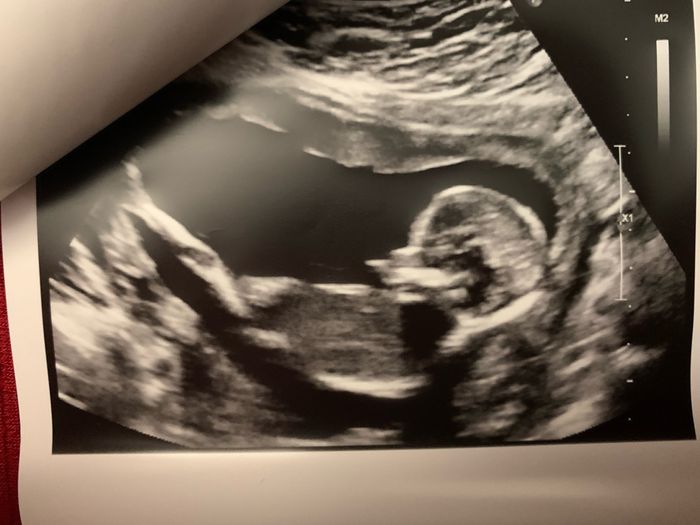 Future mamme Agosto 2021! 1