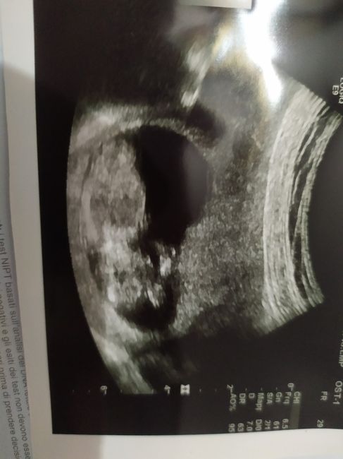 Il piccolo/piccola cresce😍😍😍 1