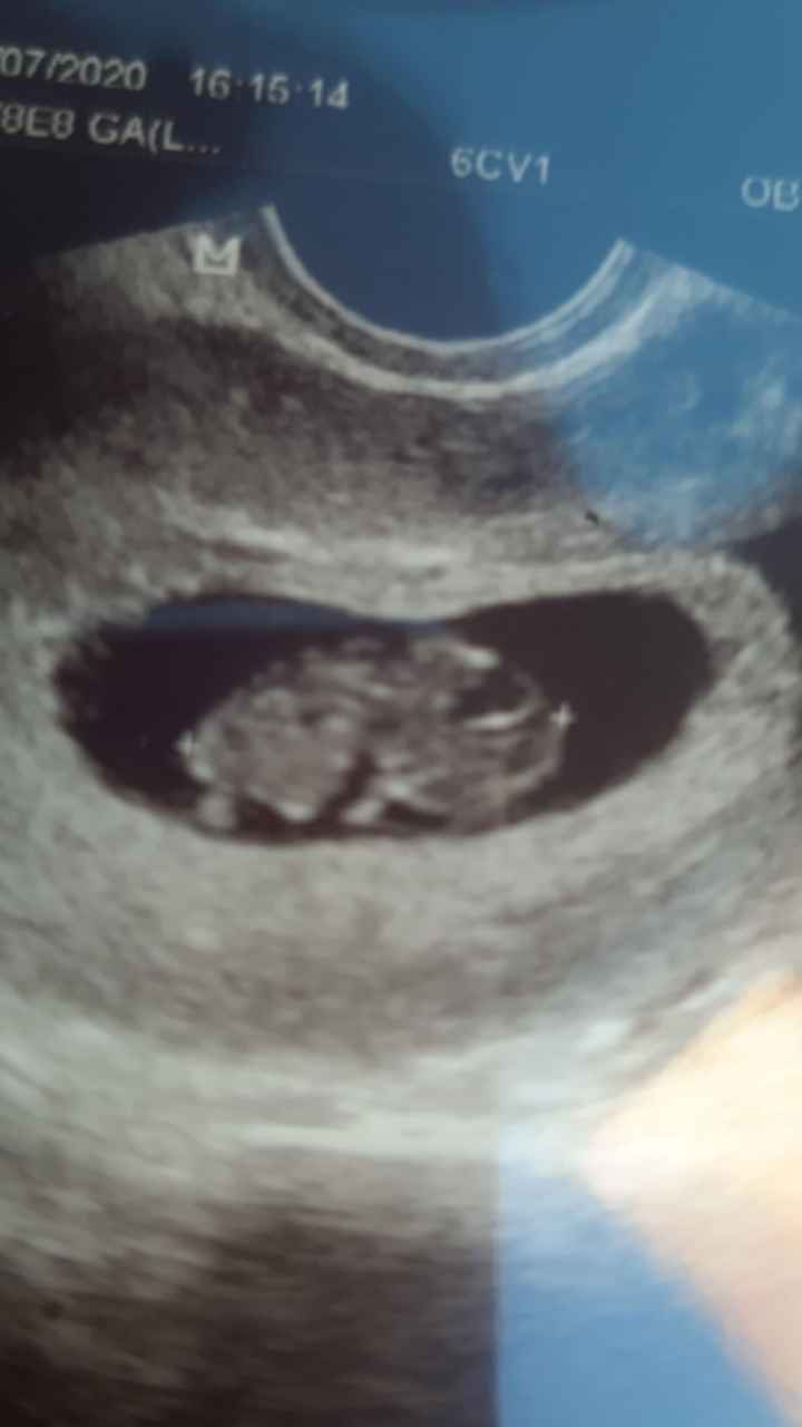 💙💜future mamme di Maggio 2022💙💜 2
