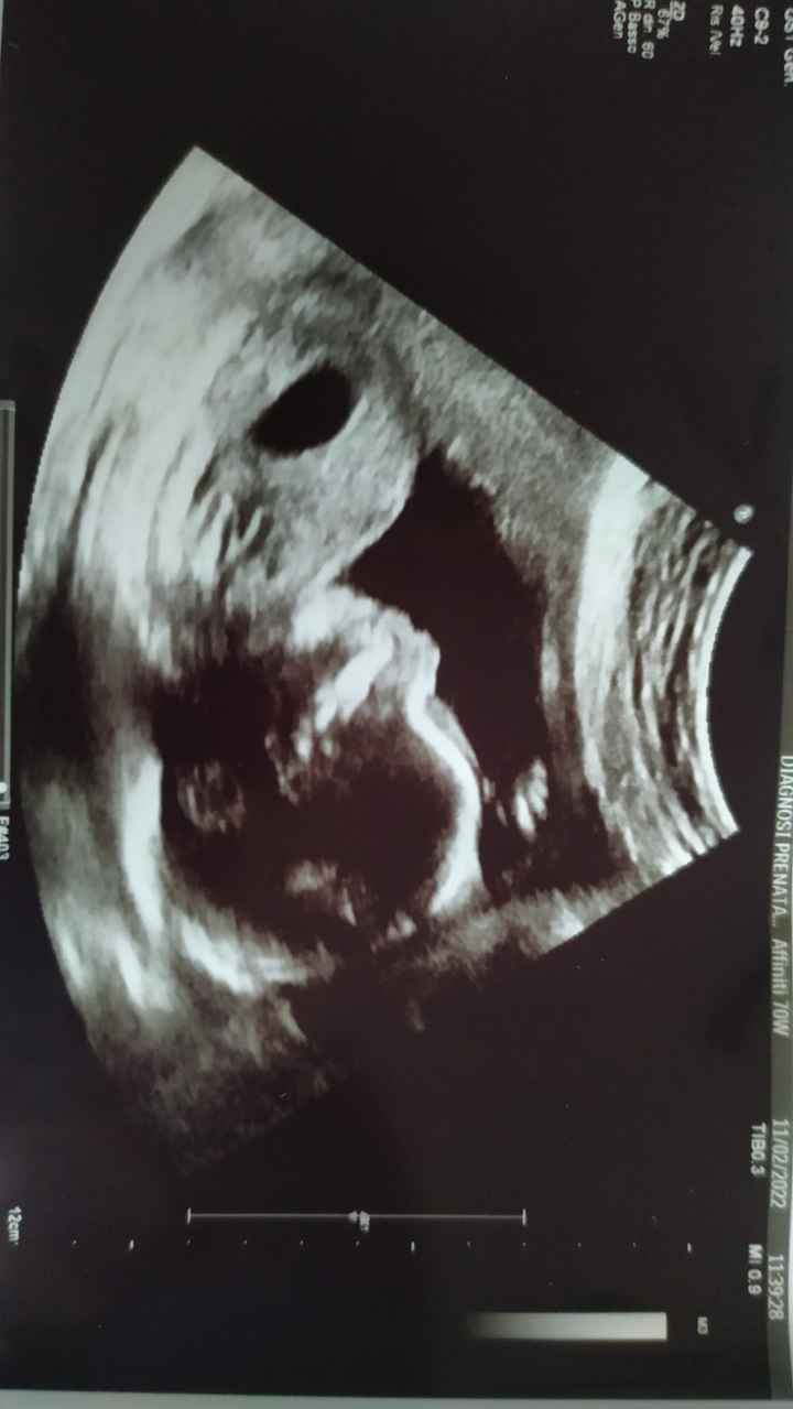 Future Mamme Giugno 2022 ❤❤❤ - 1