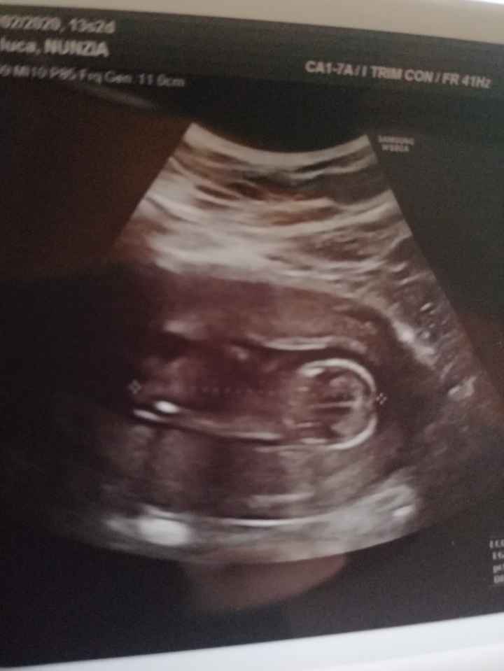 Future mamme novembre 2020 🌞🍁🌷♾ - 1