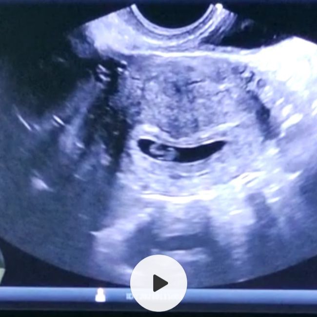 Future Mamme Settembre 2021😍 - 1